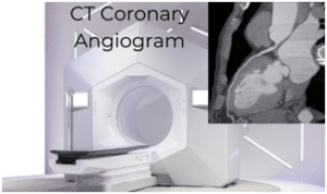 CT coronary angiogram