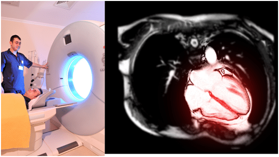 CT coronary angiography (CTCA)