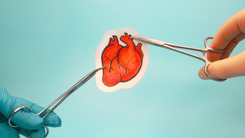 Percutaneous Coronary Intervention Singapore