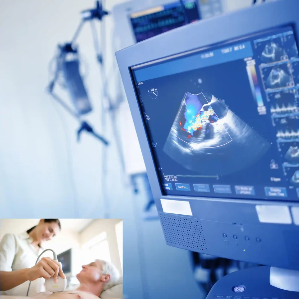 Echocardiography heart test